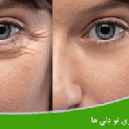 چروک دور چشم